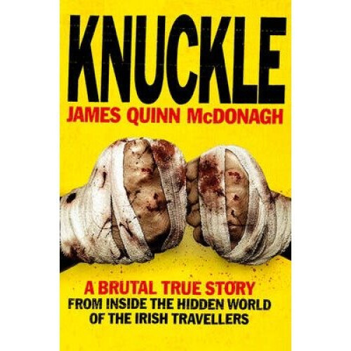 Knuckle