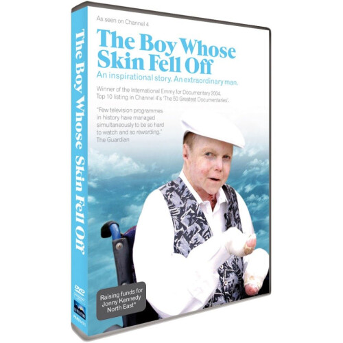 Boy Whose Skin Fell off