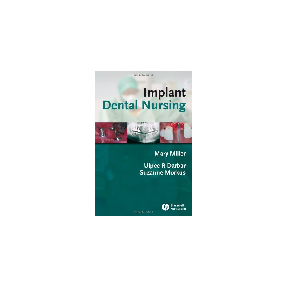 Implant Dental Nursing: Essential Guide for Dental Nurses in Implant Dentistry