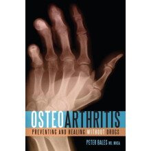 Osteoarthritis: Preventing and Healing Without Drugs