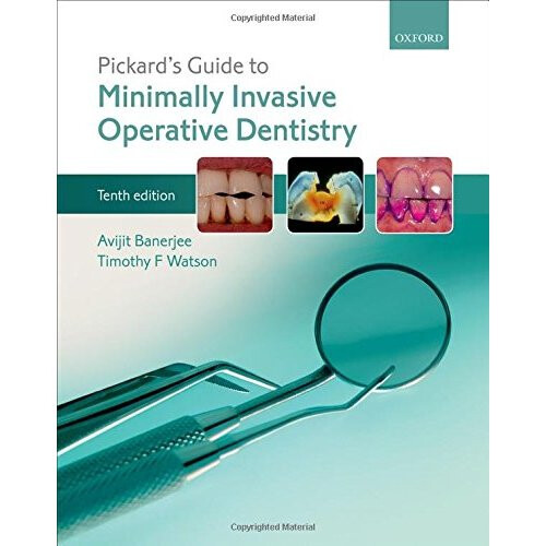 Pickard's Guide to Minimally Invasive Operative Dentistry