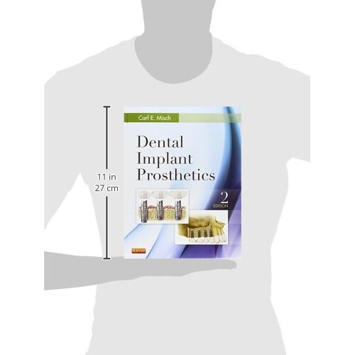 Dental Implant Prosthetics, 2e 2