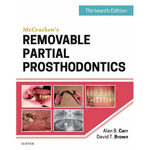 McCracken's Removable Partial Prosthodontics, 13e