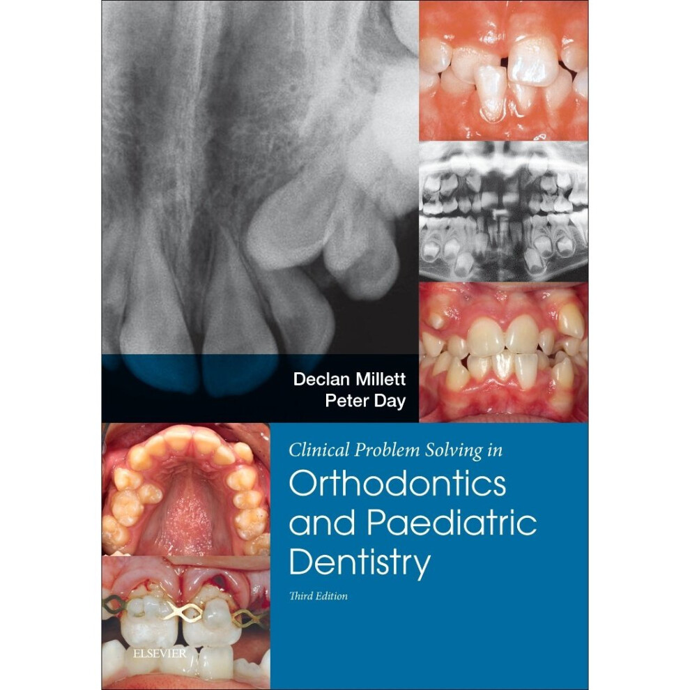 Isdp Clinical Problem Solving In Dentistry: Orthodontics And Paediatric Dentistry, 3E Size 3