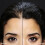 TOPPIK Toppik - Hairline Optimizer 4