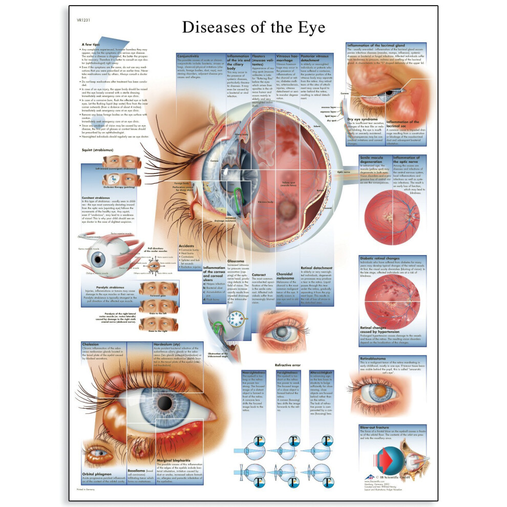 3B-Scientific 3B Scientific Human Anatomy - Diseases Of The Eye Chart, Paper Version