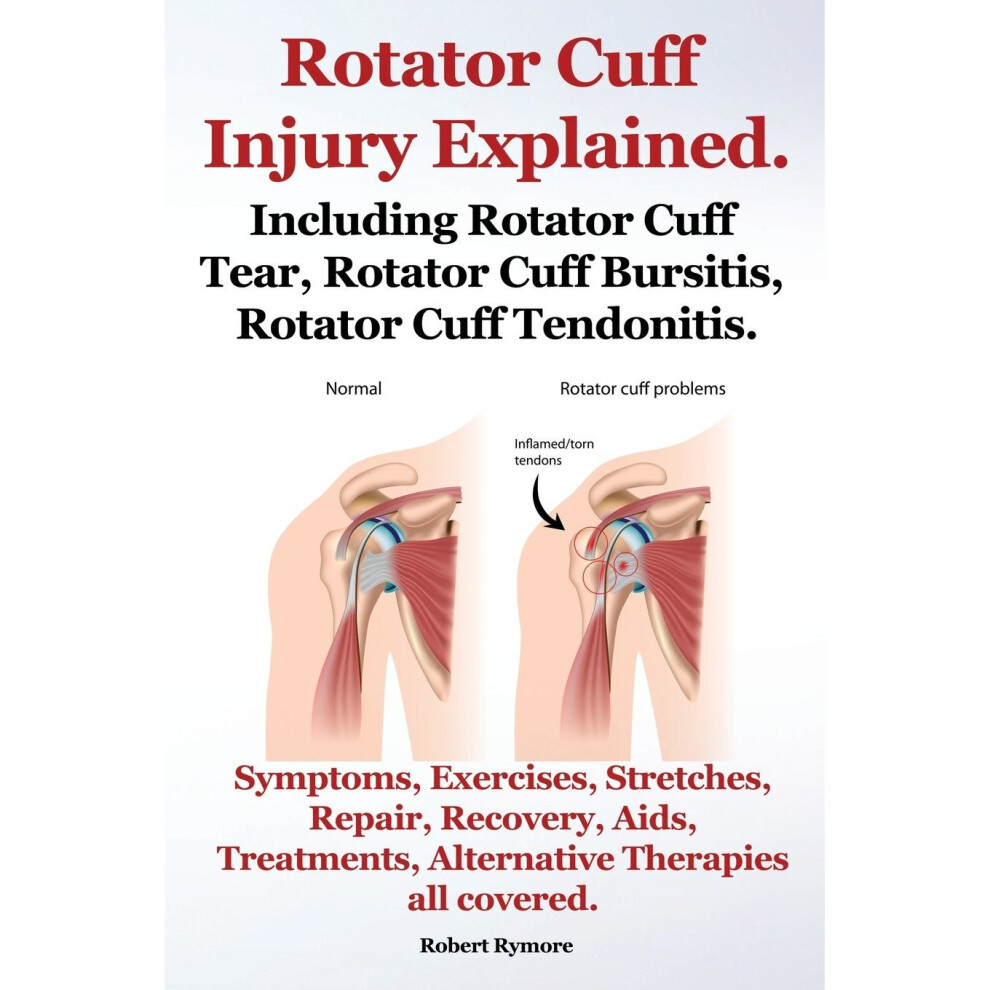 Imb-Publishing Rotator Cuff Injury Explained. Including Rotator Cuff Tear, Rotator Cuff Bursitis, Rotator Cuff Tendonitis. Symptoms, Exercises, Stretches, Repair, Re