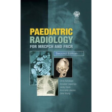Paediatric Radiology for MRCPCH and FRCR, Second Edition
