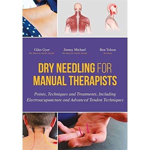 Dry Needling for Manual Therapists: Points, Techniques and Treatments, Including Electroacupuncture and Advanced Tendon Techniques 1
