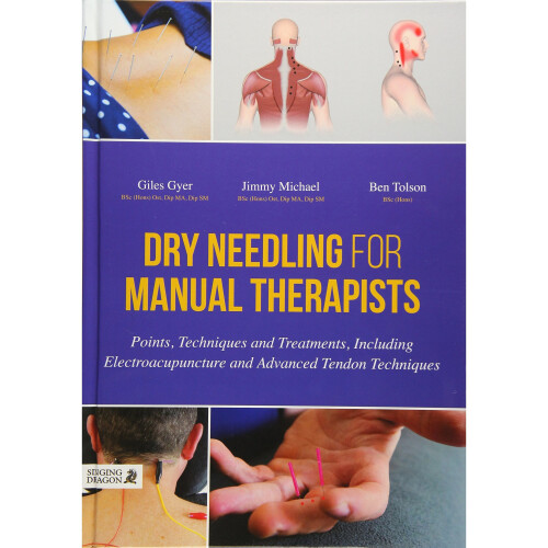 Dry Needling for Manual Therapists: Points, Techniques and Treatments, Including Electroacupuncture and Advanced Tendon Techniques