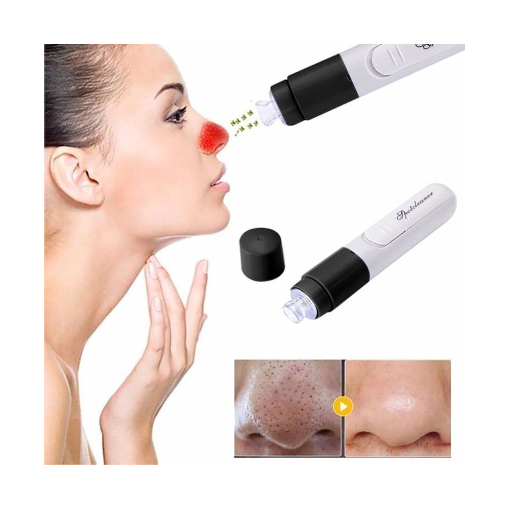 Handheld Electric Blackhead Remover Cleaner Vacuum Suction Facia Blackhead Removal Skin Care Cleansing 2017 n14