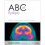 ABC of Epilepsy by W Henry Smithson 1