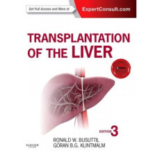 Transplantation of the Liver by Ronald Busuttil