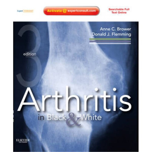 Arthritis in Black and White by Anne C Brower