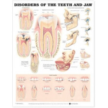 Disorders of the Teeth and Jaw Anatomical Chart