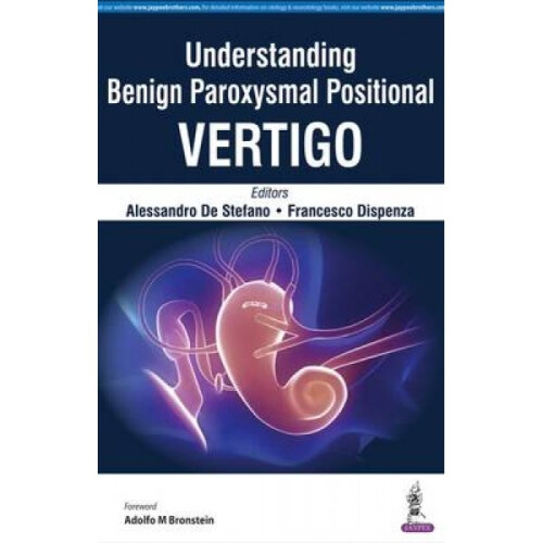 Understanding Benign Paroxysmal Positional Vertigo by Alessandro De Stefano