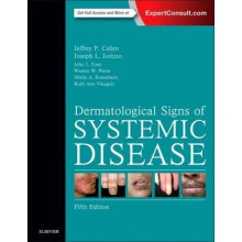 Dermatological Signs of Systemic Disease by Jeffrey Callen