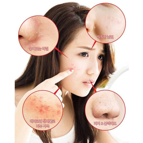 SOME BY MI, AHA. BHA. PHA 30 Ημέρες Θαύμα Τόνερ, 5.07 fl oz (150 ml) 2