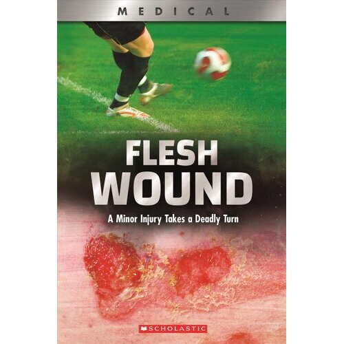 Flesh Wound (Xbooks)