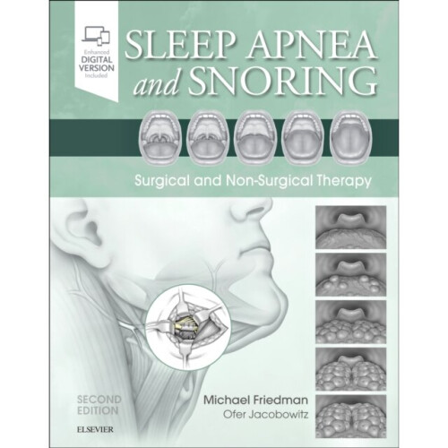 Sleep Apnea and Snoring by Michael Friedman