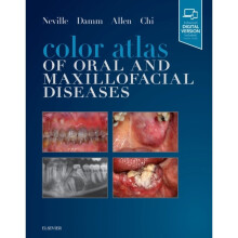 Color Atlas of Oral and Maxillofacial Diseases by Neville & Brad W. & DDSDamm & Douglas D.Allen & Ca