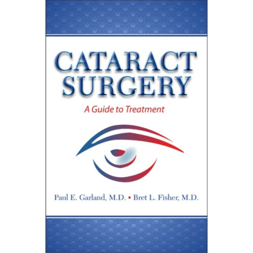 Cataract Surgery by Garland Paul