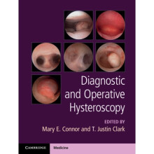 Diagnostic and Operative Hysteroscopy by Edited by Mary Connor & Edited by Justin Clark