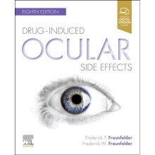 Drug-Induced Ocular Side Effects by Fraunfelder & Frederick T. & MDFraunfelder & Frederick W.