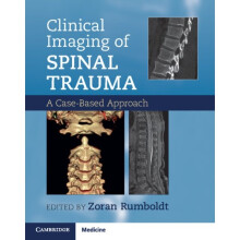 Clinical Imaging of Spinal Trauma by Zoran Rumboldt