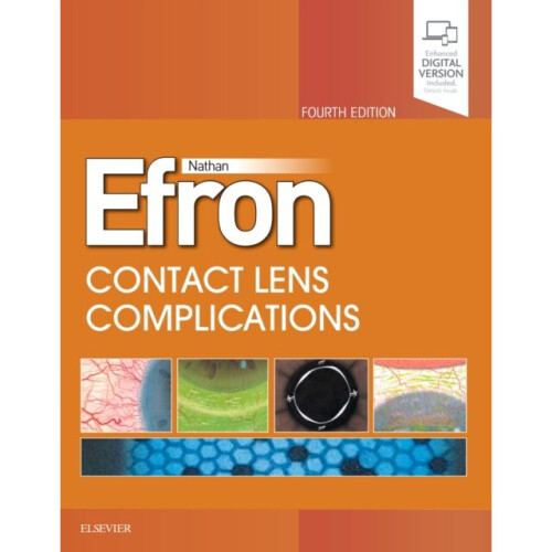 Contact Lens Complications by Efron & Nathan
