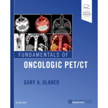 Fundamentals of Oncologic PETCT by Ulaner & Gary A.