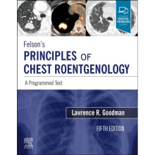 Felsons Principles of Chest Roentgenology A Programmed Text by Goodman & Lawrence R.