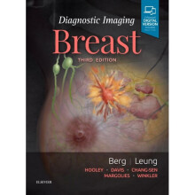 Diagnostic Imaging Breast by Berg & Wendie A.Leung & Jessica