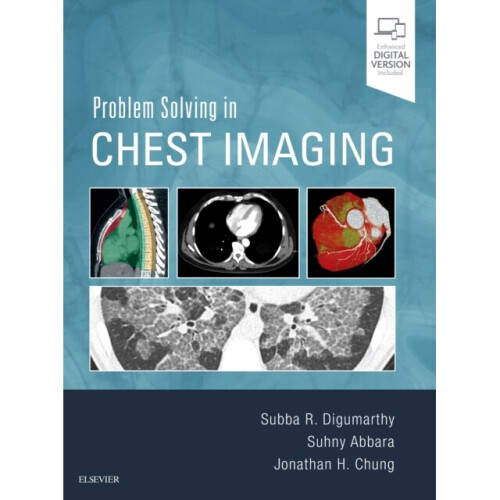 Problem Solving in Chest Imaging by Digumarthy & Subba R.Abbara & SuhnyChung & Jonathan H.