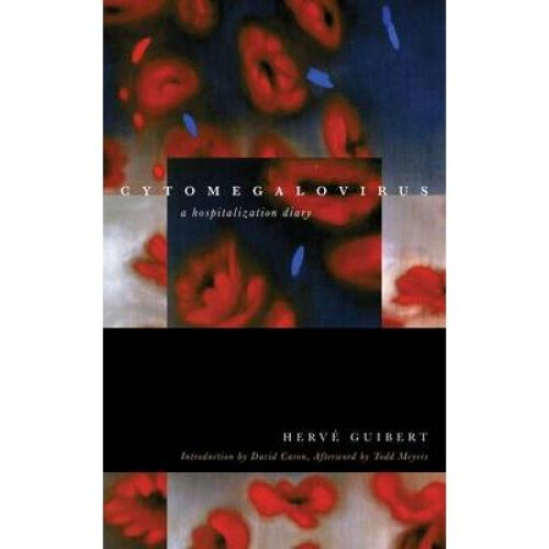 Cytomegalovirus by Guibert & Herve