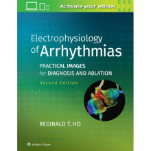 Electrophysiology of Arrhythmias by Ho & Reginald T.