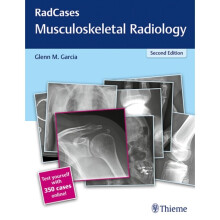 RadCases Q&A Musculoskeletal Radiology by Edited by Glenn M Garcia