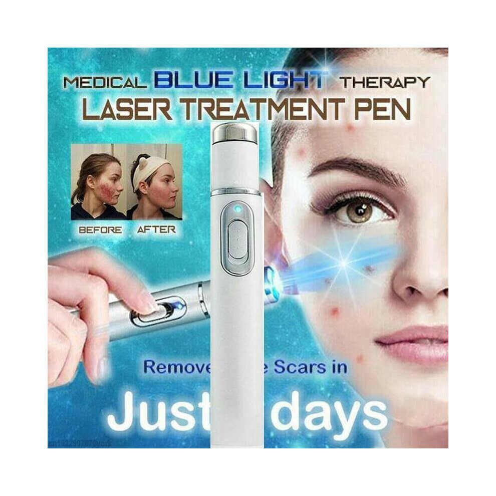 Red Portable Acne Laser Pen For Acne, Blemishes, Scars And Wrinkle Uction - Pore Tightening Skin Rejuvenation Tool