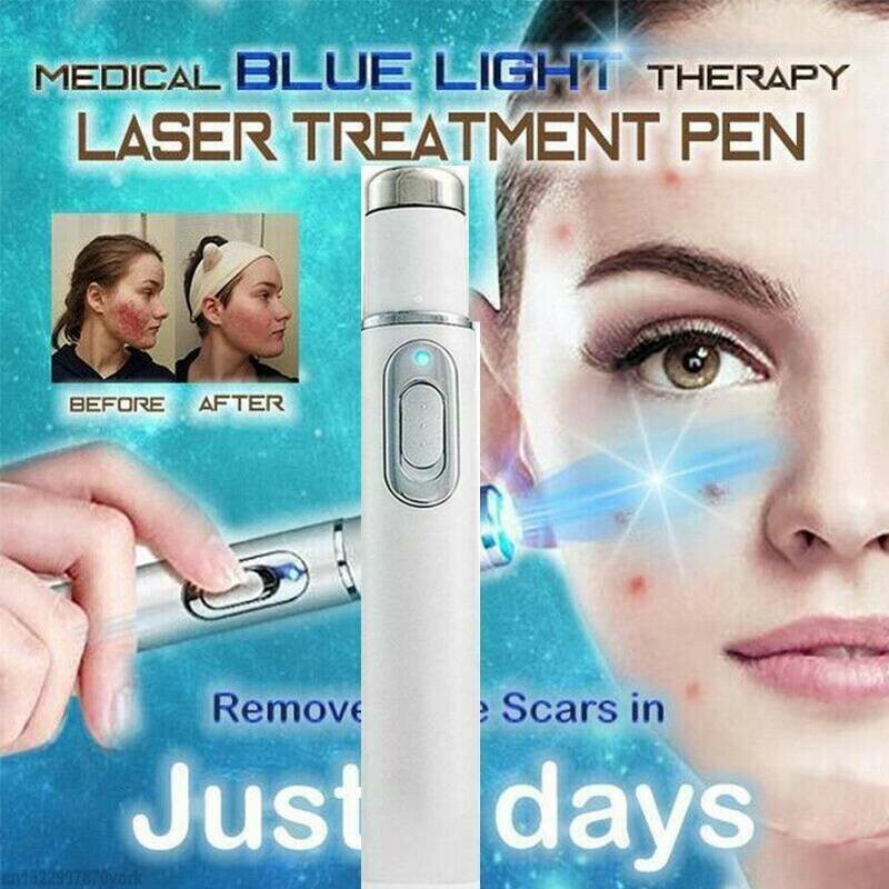 Acne Laser Pen Portable Wrinkle Skin Spots Herpes Cold Sore Scar