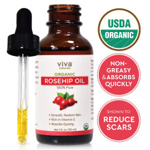 Organic Rosehip Seed Oil for Face - 100% Pure Cold Pressed Facial Oil, Reduces the Appearance of Scars, Natural Non-Greasy Moisturizing Serum for Dry