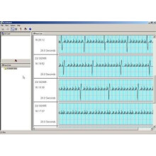 Omron HCG-801 Heartscan ECG Software Extension Pack (no monitor)