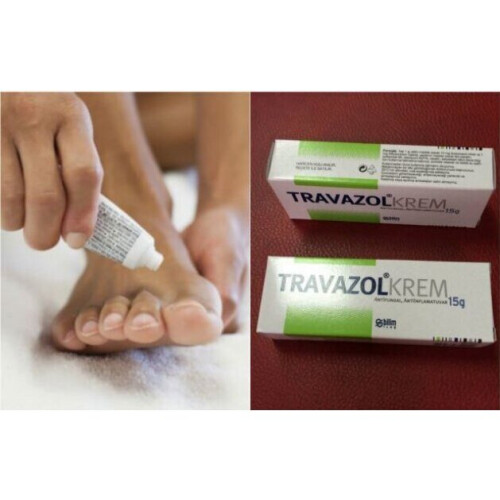 TRAVAZOL Cream 15g Antifungals Genital Itching Severe Inflammation