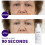 Beverly Hills Instant Facelift - Reduce Fine Lines 4