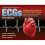 The Complete Guide to Ecgs: A Comprehensive Study Guide to Improve ECG Interpretation Skills 1