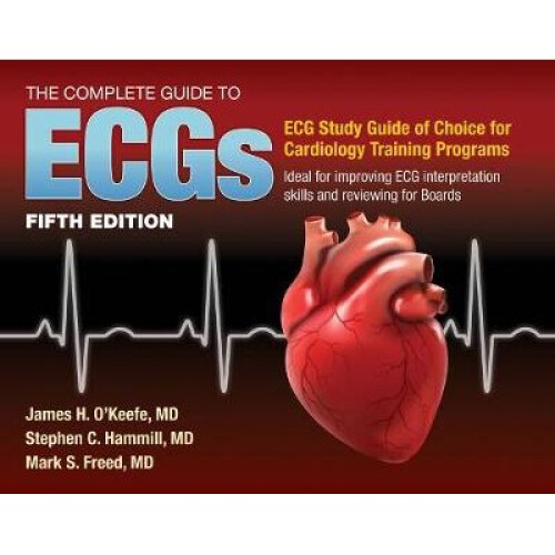 The Complete Guide to Ecgs: A Comprehensive Study Guide to Improve ECG Interpretation Skills