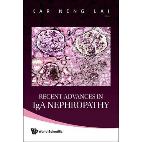 Recent Advances In Iga Nephropathy