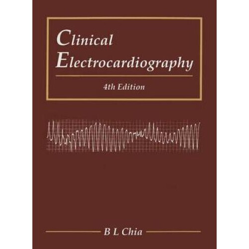 Clinical Electrocardiography (Fourth Edition)