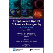 Swept-source Optical Coherence Tomography: A Color Atlas (Second Edition)