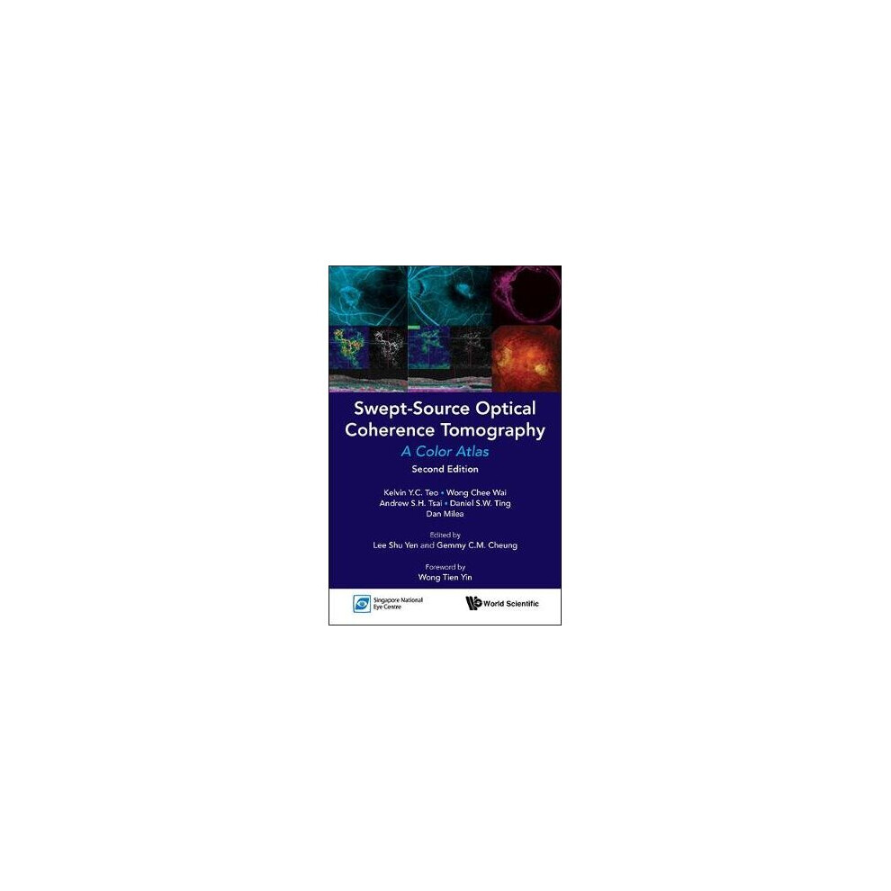 Swept-source Optical Coherence Tomography: A Color Atlas (Second Edition)