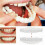 Smile Snap On Upper False Teeth Dental Veneers Dentures Tooth Cover Set 1